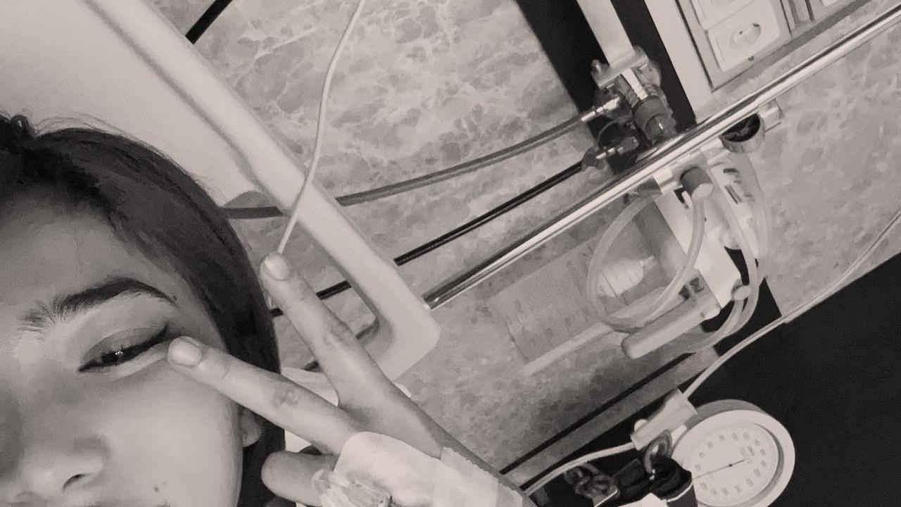 Isyana Sarasvati Sering Bolak-Balik Rumah Sakit, Baru Terungkap Dirinya Mengidap Autoimun SLE