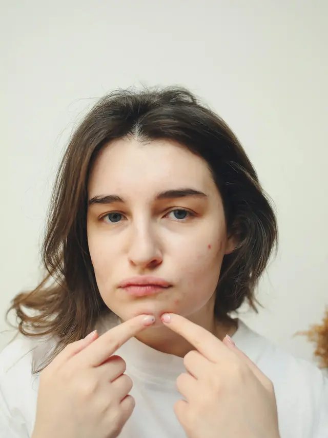 Muncul Jerawat Setelah Facial, Normal Nggak Sih? Gali Fakta dan Tips Perawatan yang Tepat