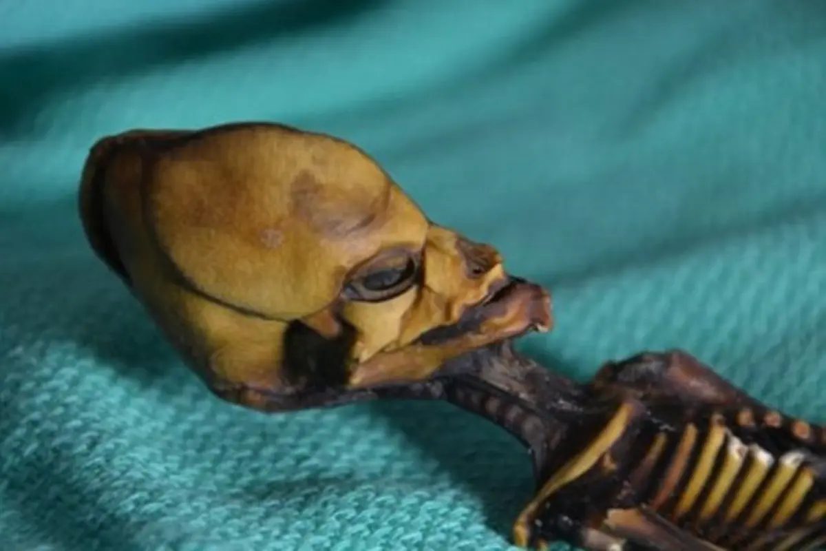 Dikira Alien, Mumi Berkepala Kerucut Ternyata Bayi Perempuan Berpenyakit Langka