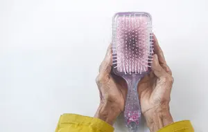 Transplantasi Rambut: Pengertian, Prosedur, Risiko, dan Hal yang Perlu Diketahui
