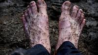 Amor rela kakinya dikerumuni puluhan nyamuk kecil selama 1 menit demi mendapatkan gambaran kehidupan alam liar (Dailymail.com). 