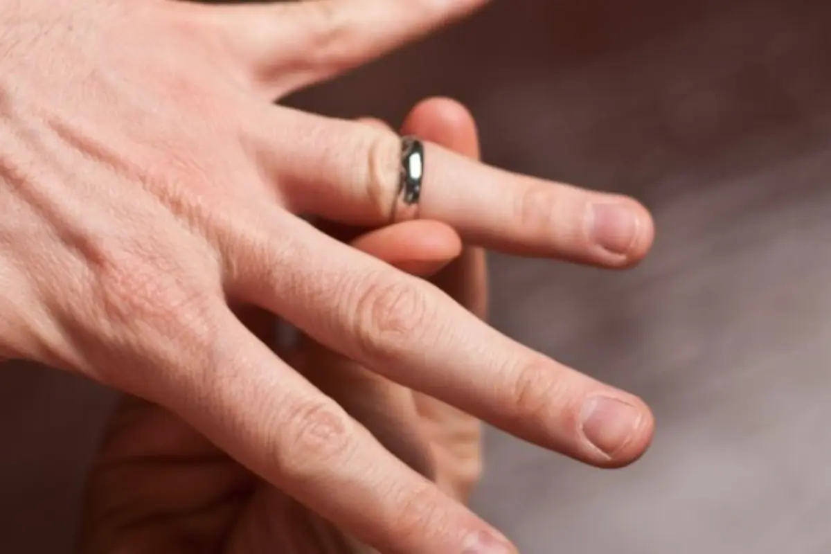 Begini Selamatkan Nyawa dari Cincin yang Terjebak di Jari