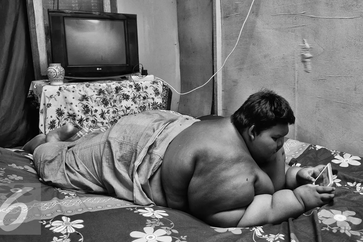 20160630-Obesitas-Ariya-Permana-GMS