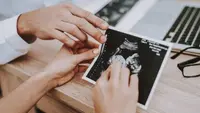 Ilustrasi hasil USG. (iStockphoto)