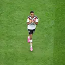 Jamal Musiala Ternyata Main dengan Pelat Logam di Piala Dunia 2026