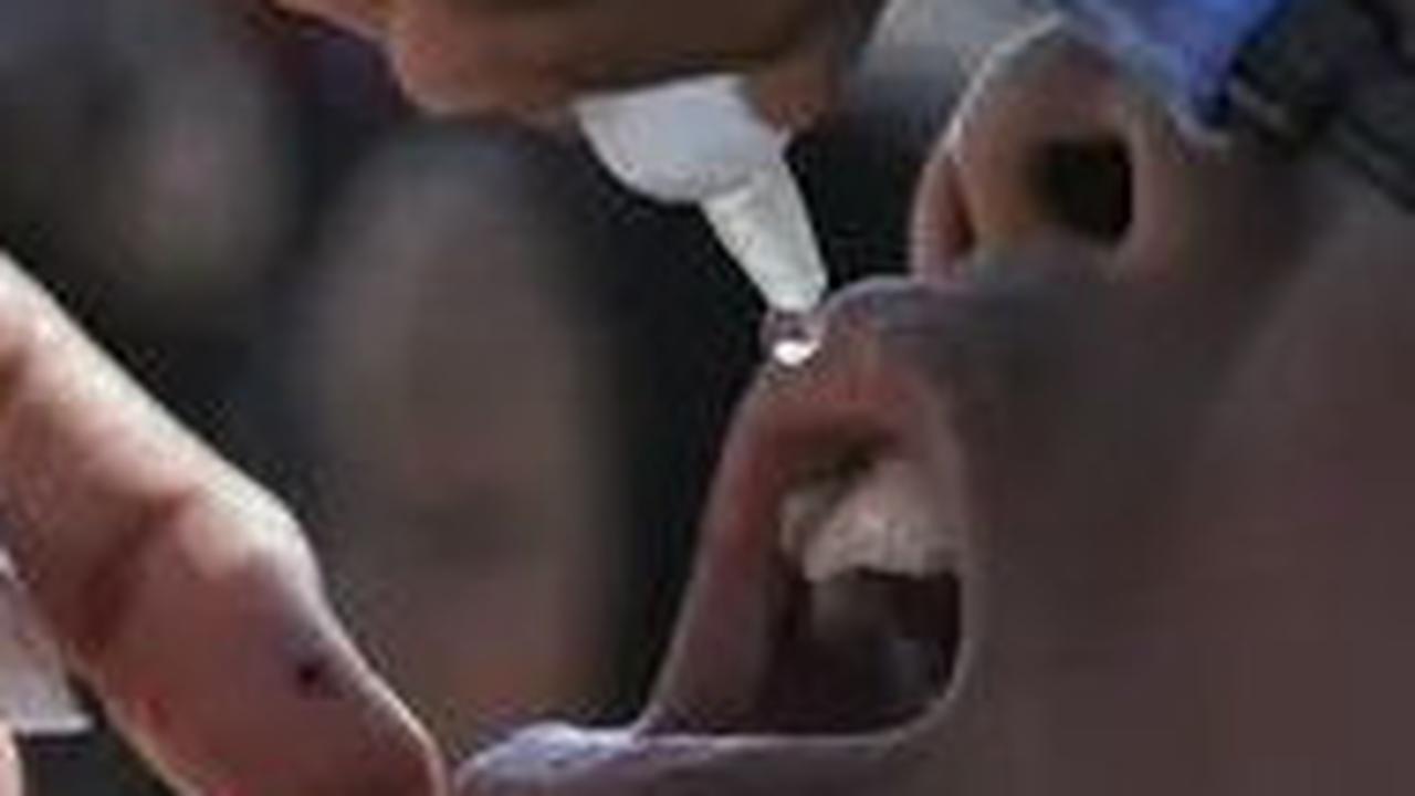 Kondisi Terkini Anak Kena Polio di Klaten