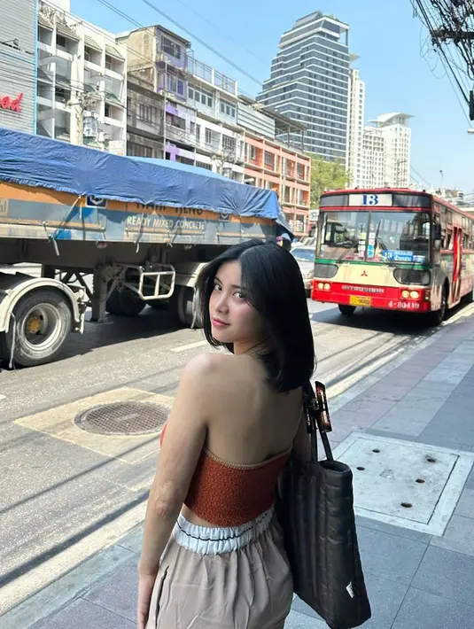 Dalam unggahan Instagramnya, foto ini menjadi salah satu yang paling disorot. Pasalnya di tangan kirinya ini terlihat bekas luka bakar yang pada saat masih kecil tersiram air panas. Banyak netizen menanyakan mengenai luka tersebut dalam media sosial Instagramnya. (Liputan6.com/IG/@melati.sesilia)