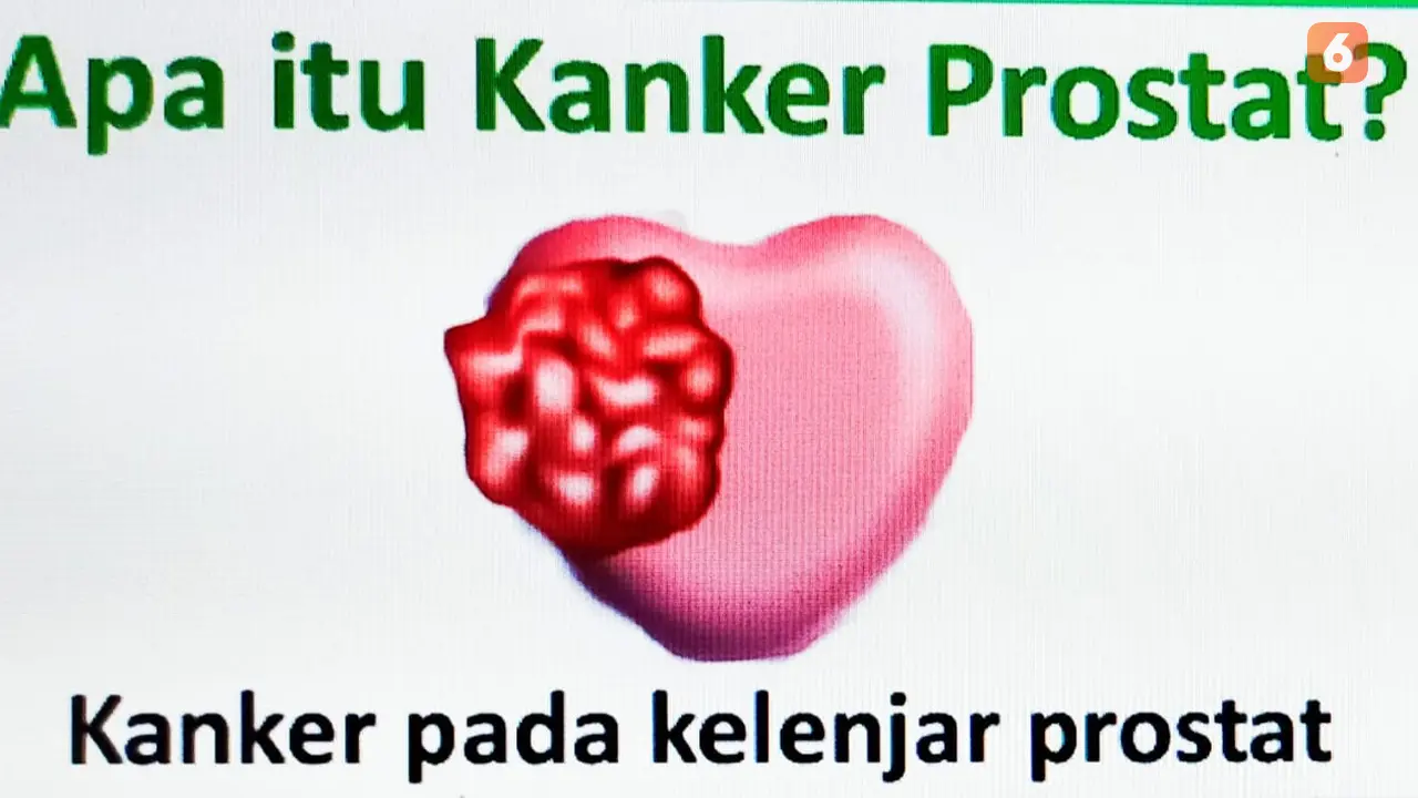 Kanker Prostat