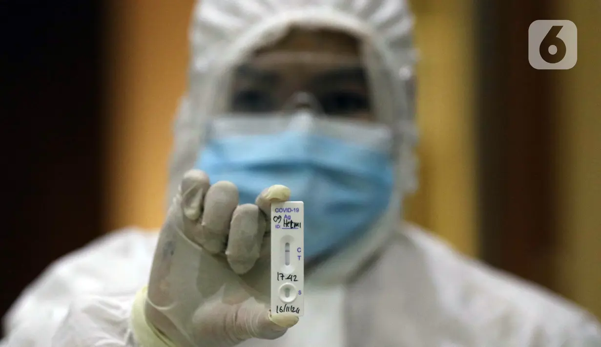 Petugas medis menunjukkan hasil rapid test antigen di ruang wartawan Gedung KPK, Jakarta, Senin (16/11/2020). Sejak diumumkan pertama kali pada Maret 2020 hingga Senin (16/11) kasus konfirmasi positif Covid-19 di Indonesia secara keseluruhan mencapai 470.648 kasus. (Liputan6.com/Helmi Fithriansyah)