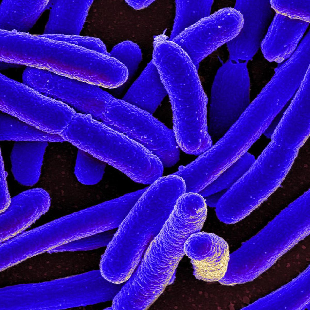 Escherichia coli