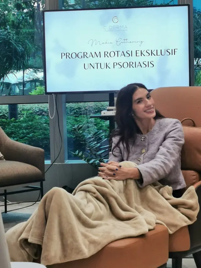 Nadila Ernesta menceritakan perjuangannya melawan penyakit Psoriasis.