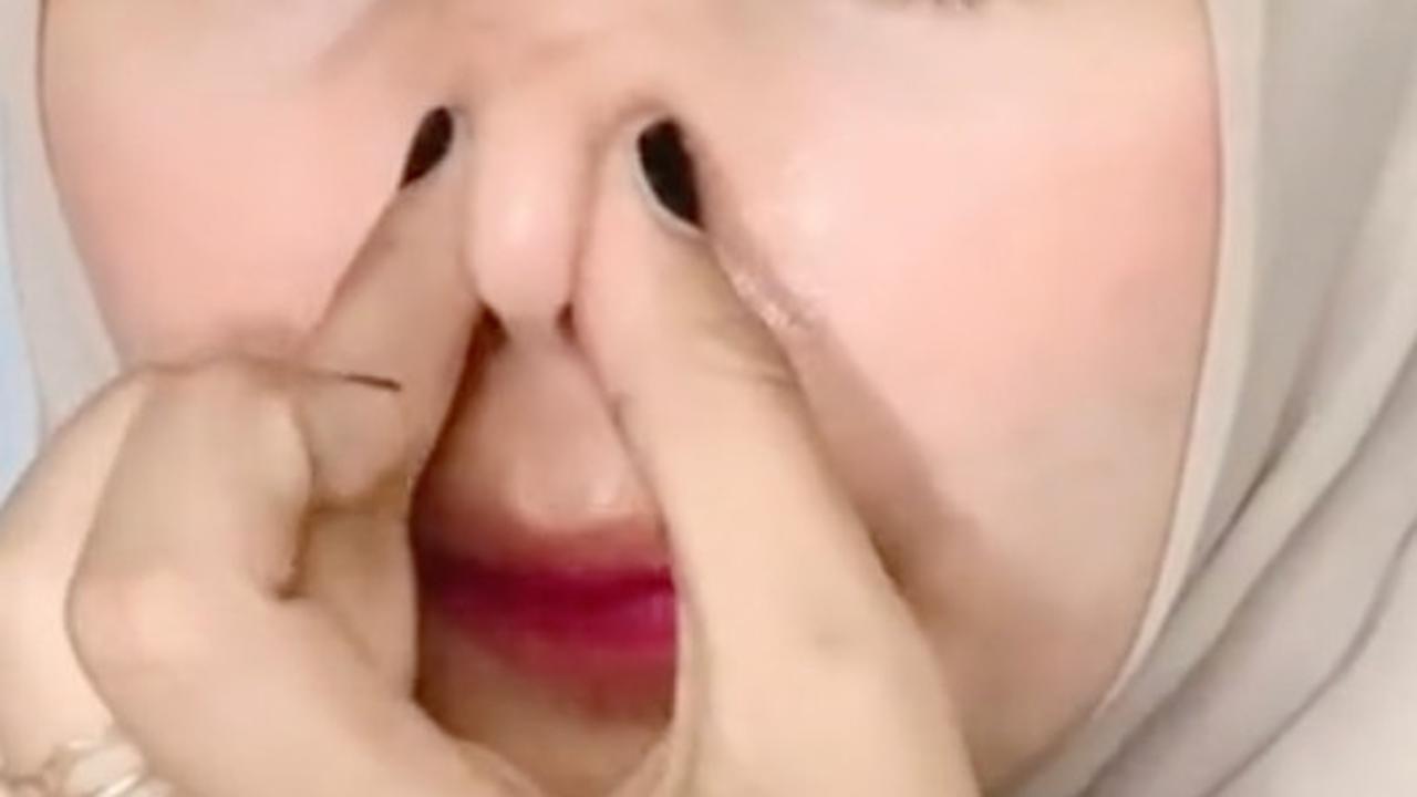 Dokter Kulit Ungkap 4 Cara Membuat Hidung Mancung
