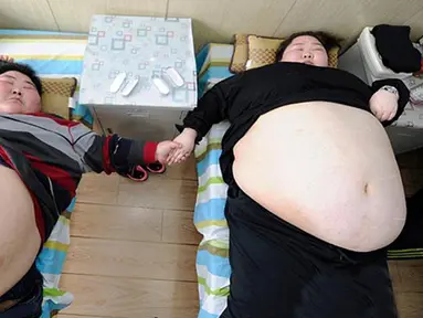 Pasangan obesitas asal Sichuan, Lin Yue dan Deng Yang ingin menjalani operasi untuk menurunkan berat badan, sehingga mereka bisa berhubungan seks dan memulai sebuah keluarga. (dailymail.co.uk)