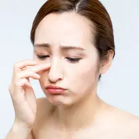 Mengatasi whitehead dengan gunakan produk skincare yang memiliki kandungan tertentu/copyright shutterstock/metamorworks