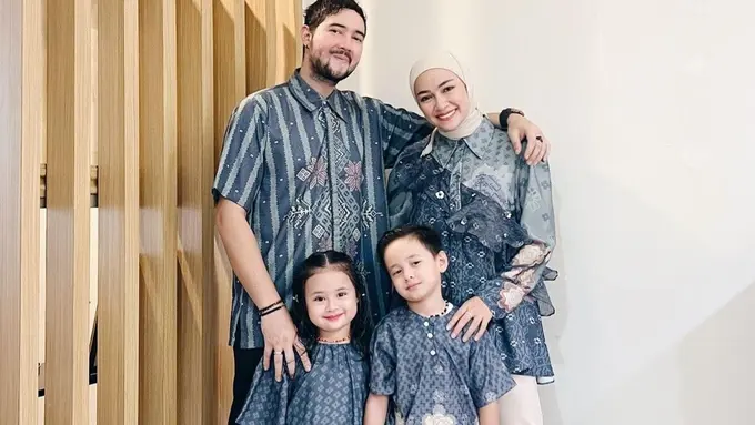 Potret Aleia anak Aryani Fitriana yang disebut seperti boneka hidup