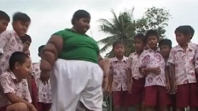 Kembali ke Sekolah, Arya Bocah Obesitas Main Sepak Bola