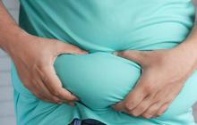 Waspada! Obesitas Sejak Muda Bisa Picu Risiko Kematian Dini hingga 70 Persen