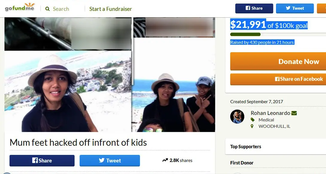 Aksi galang dana online di situs GoFundMe itu digagas Rohan Leonardo atas dasar kepeduliannya terhadap nasib istri yang dipotong kakinya oleh sang suami di Denpasar, Bali. (Foto: gofundme.com/Rohan Leonardo)