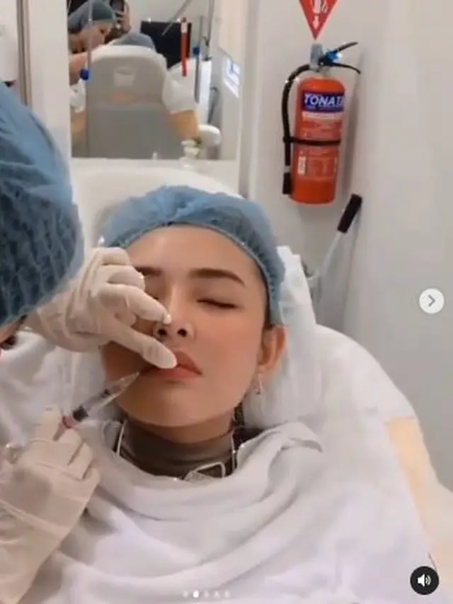 6 Potret Amanda Manopo Jalani Perawatan Wajah Suntik Dagu dan Pipi