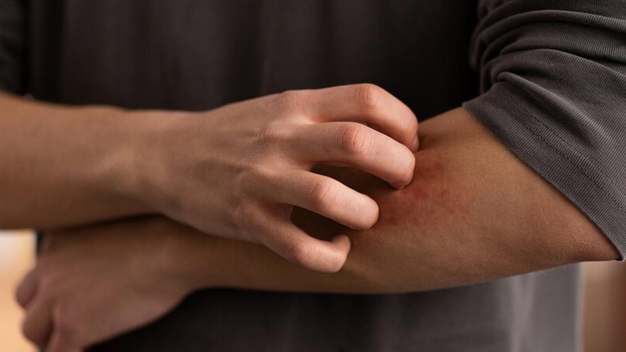 Cara Mengatasi Alergi Dingin: Panduan Lengkap dan Efektif