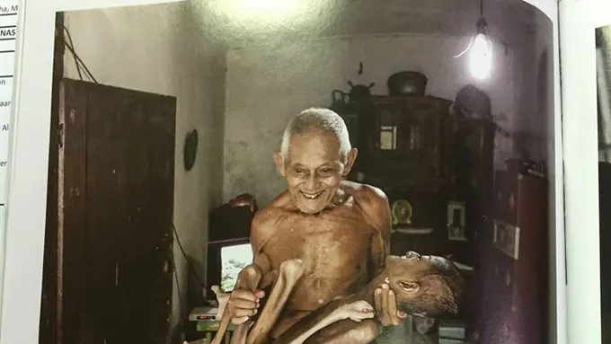 Anak Gizi Buruk di Jabar, Netizen Ramai-ramai Lapor Gubernur Aher