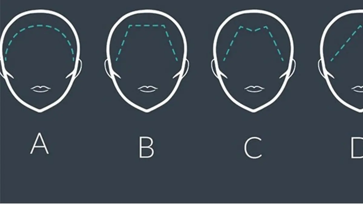 Berita Garis Rambut Hari Ini - Kabar Terbaru Terkini | Liputan6.com