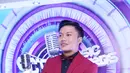 Secara tidak langsung, Rizky Febian sudah menunjukan bukti kualitas vokal dan performa di belantika musik Indonesia. Rizky Febian telah menunjukan prestasi kepada orang yang telah memandang sebelah mata. (Nurwahyunan/Bintang.com)