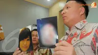 Korban Penyiraman Air Keras Mantan Pacar Belum Bisa Melihat