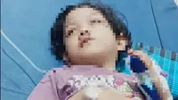 Cerita Wali Kota Makassar Bantu Biaya Pengobatan Anak Warga Kurang Mampu