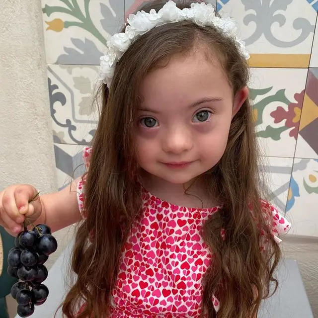 francesca model down syndrome berusia 4 tahun