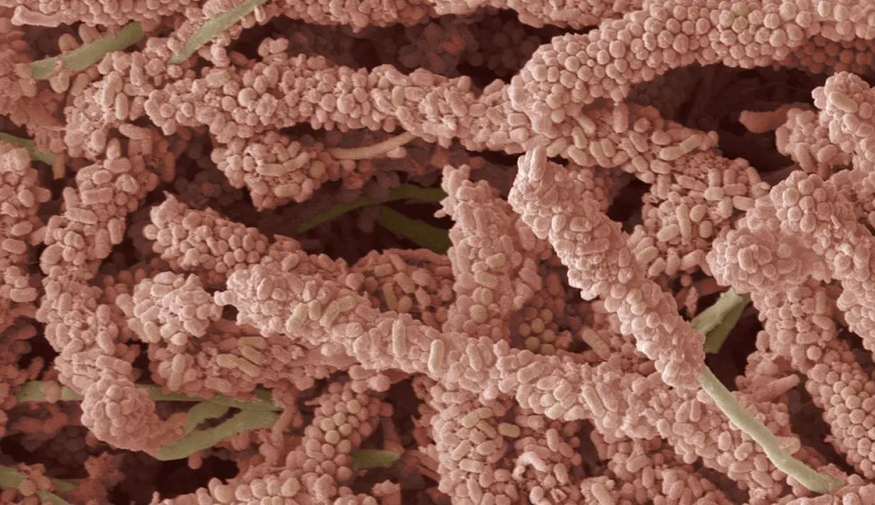 биопленка микробиология. зубная бляшка под микроскопом. бактерии под микроскопом. зубная бактерия. налет на зубах под микроскопом.