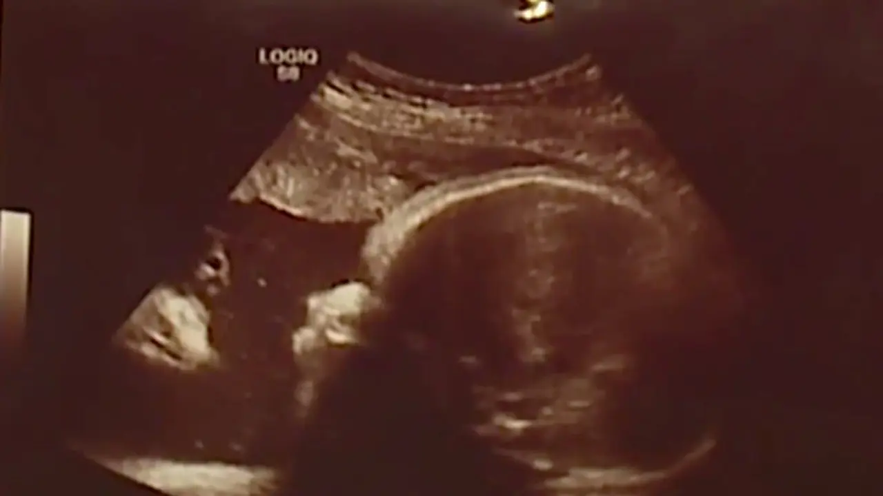 Sonogram Bayi