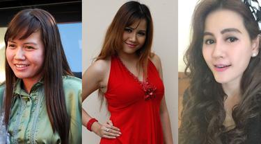 Nita Talia Tak Malu Akui Lakukan Operasi Plastik Demi Pertahankan Rumah Tangga Lifestyle Fimela Com 542 likes · 2 talking about this. nita talia tak malu akui lakukan