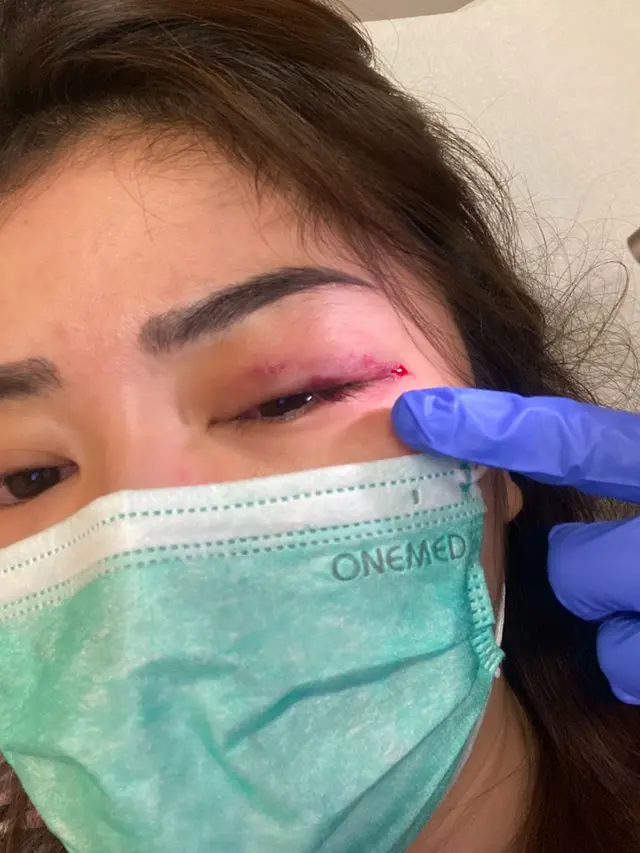 Sepupu Calon Istri Fritz Hutapea Jadi Korban KDRT