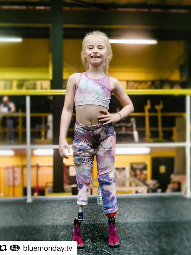 Daisy May, Model Cilik Disabilitas (sumber: instagram/@daisymay_demetre)