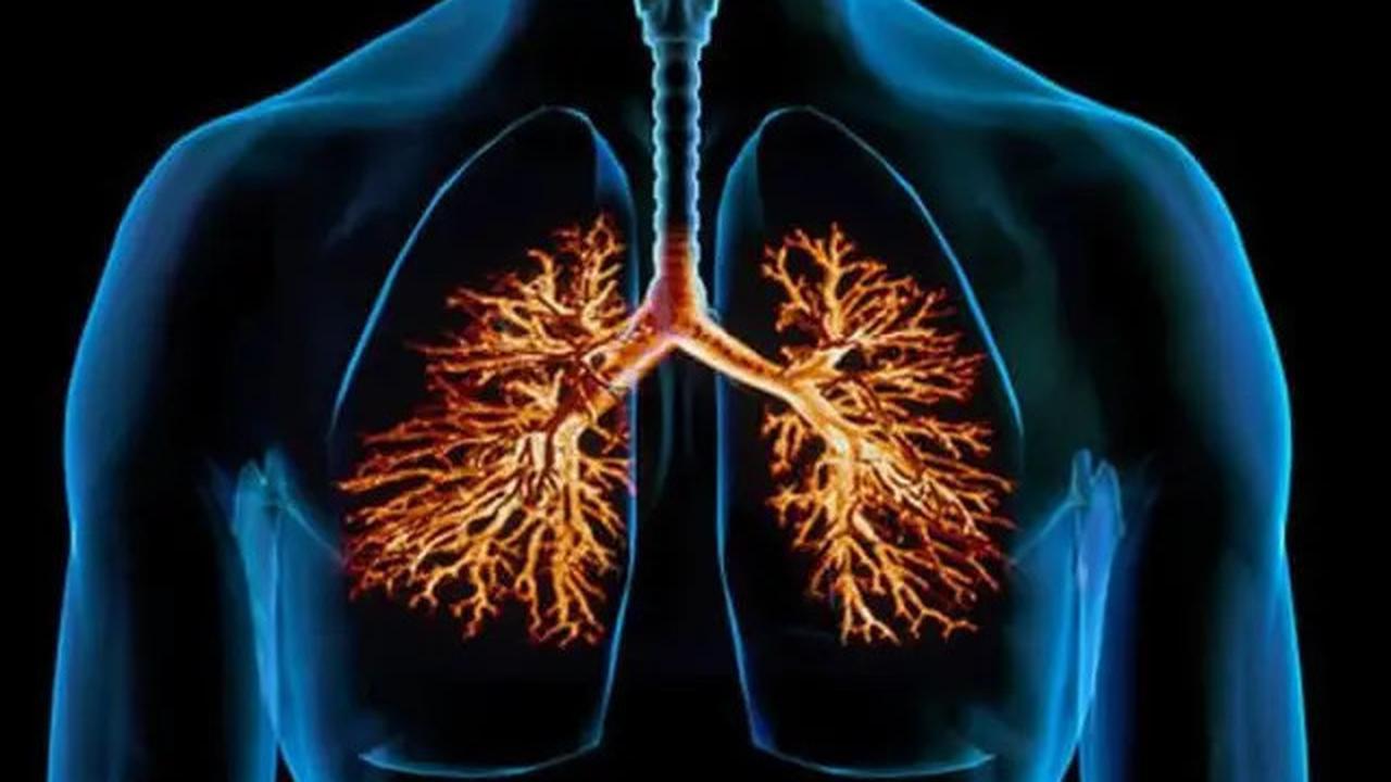 Dampak Buruk Polusi Udara, Kenali Gejala Bronkitis pada Anak