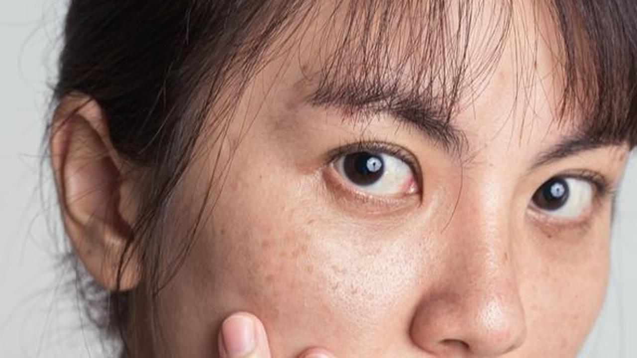 Tanda-Tanda Kulit Mengalami Penuaan Dini, Segera Berikan Perawatan yang Tepat