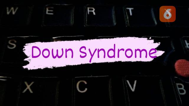 Down Syndrome