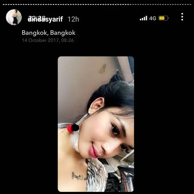 6 Potret Terbaru Dinda Syarif Usai Operasi Penghilangan Jakun, Curi Perhatian