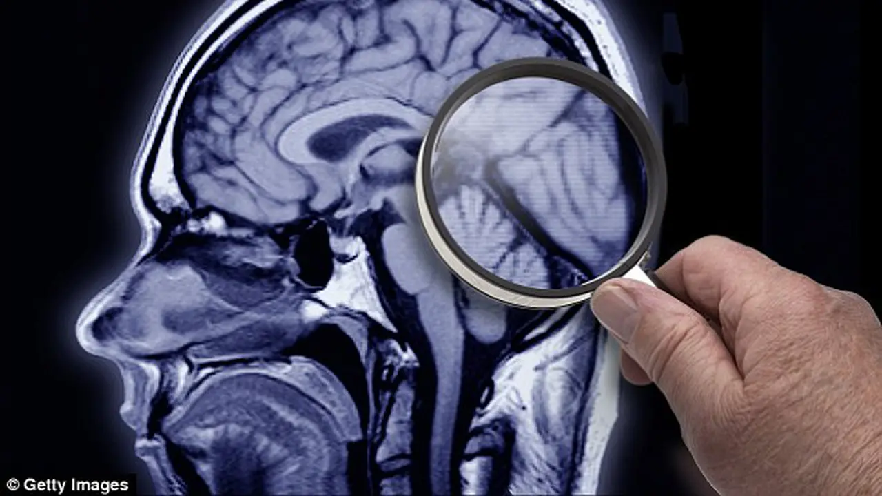 Tes Kulit Dapat Ketahui Apakah Menderita Alzheimer atau Parkinson