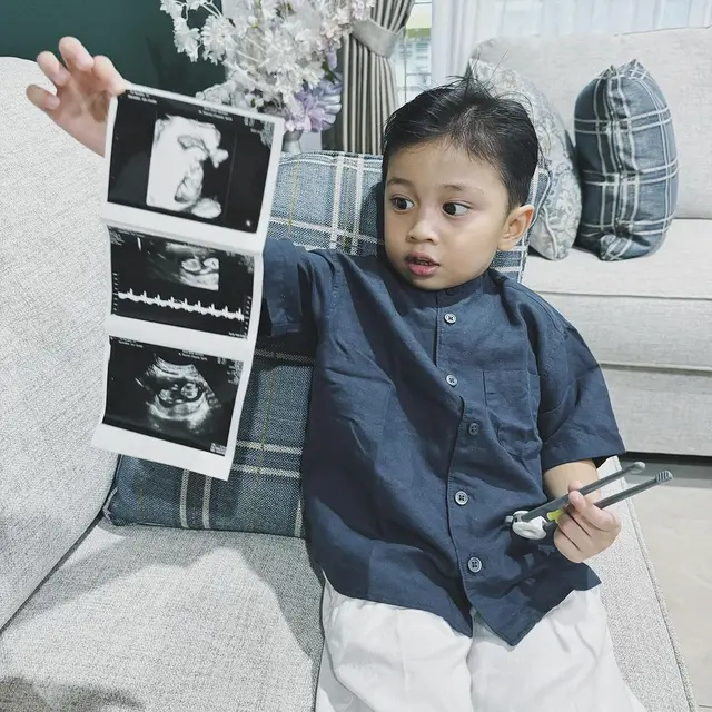 Selebgram Ira Nandha Umumkan Hamil Anak Kedua Usai Rujuk dengan Elmer