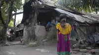 Lahir Tanpa Wajah, Wanita Ini Mengaku Bahagia
