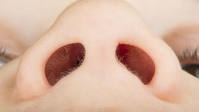 Dampak Buruk Mencabut Bulu Hidung