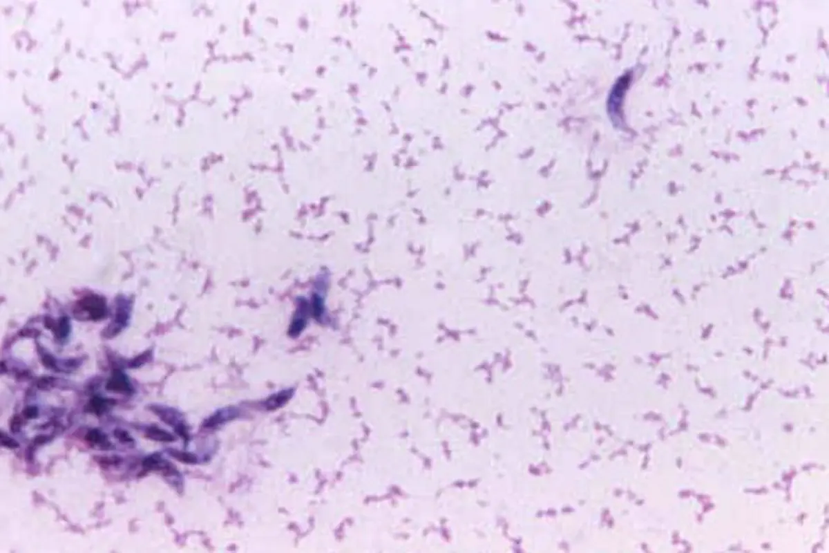 Toxoplasma gondii (0)