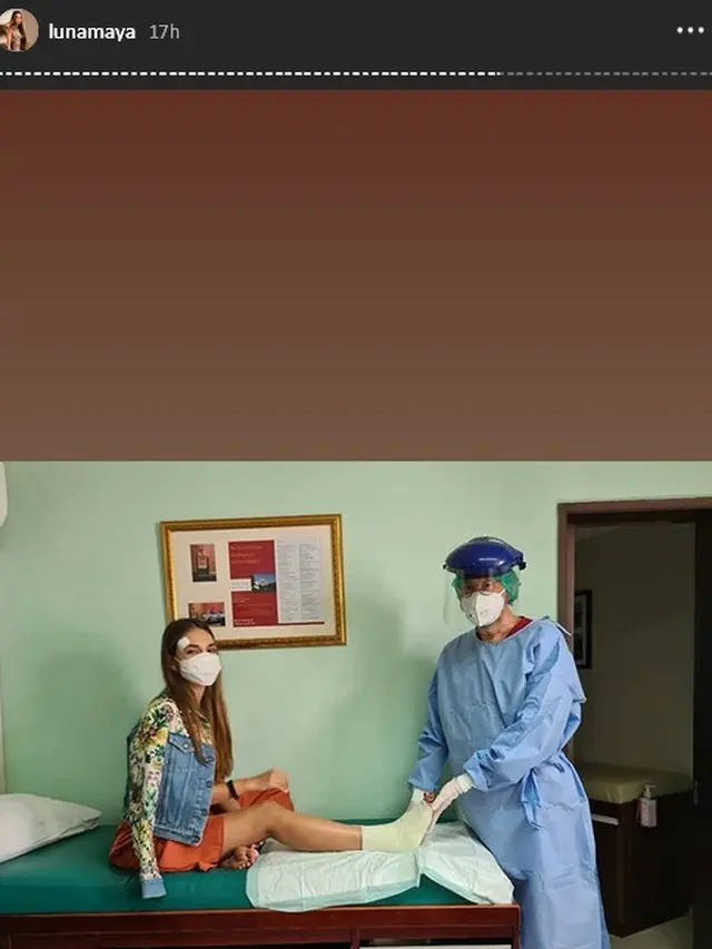 Alami Patah Tulang Metatarsal, Ini 6 Potret Kondisi Terbaru Luna Maya