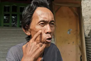 Sudrajat (50) pedagang es kue menjadi korban penyiksaan yang dilakukan oknum TNI dan Polri. (Dicky Agung Prihanto/Liputan6.com)