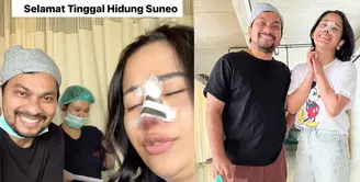 Tak mau disebut hidung Suneo, Farida Nurhan memutuskan operasi plastik di hidungnya. Perempuan kelahiran Lumajang 41 tahun silam itu mempercayakan ke dr Tompi. [Instagram/farida.nurhan]