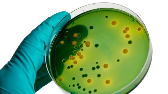 Bakteri Vibrio, Ancaman Kesehatan Apakah Ini? (Sompraaong0042/Shutterstock)