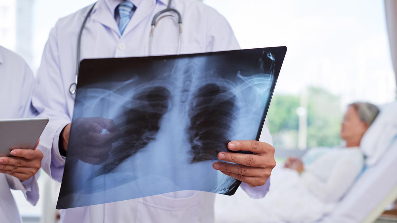 Diagnosis paru-paru basah 