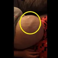 Sebuah video unik memperlihatkan jabang bayi masih dalam kandungan menendang perut ibunya dengan sekuat tenaga. Kakinya terlihat.